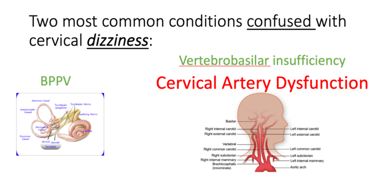 cervical+dizziness (1)