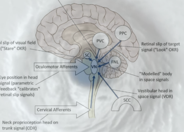 cervicogenic+dizziness+vestibular+nucleus (1)